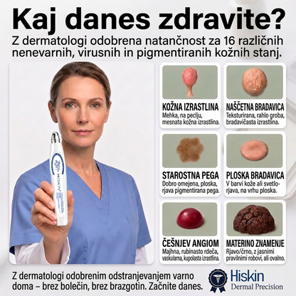 🎁 Posebna ponudba se kmalu izteče! Zdaj lahko prejmete dodatnih 30 % popusta, dokler so zaloge na voljo. Naročite še danes in izkoristite eno najboljših ponudb te sezone! 🔥