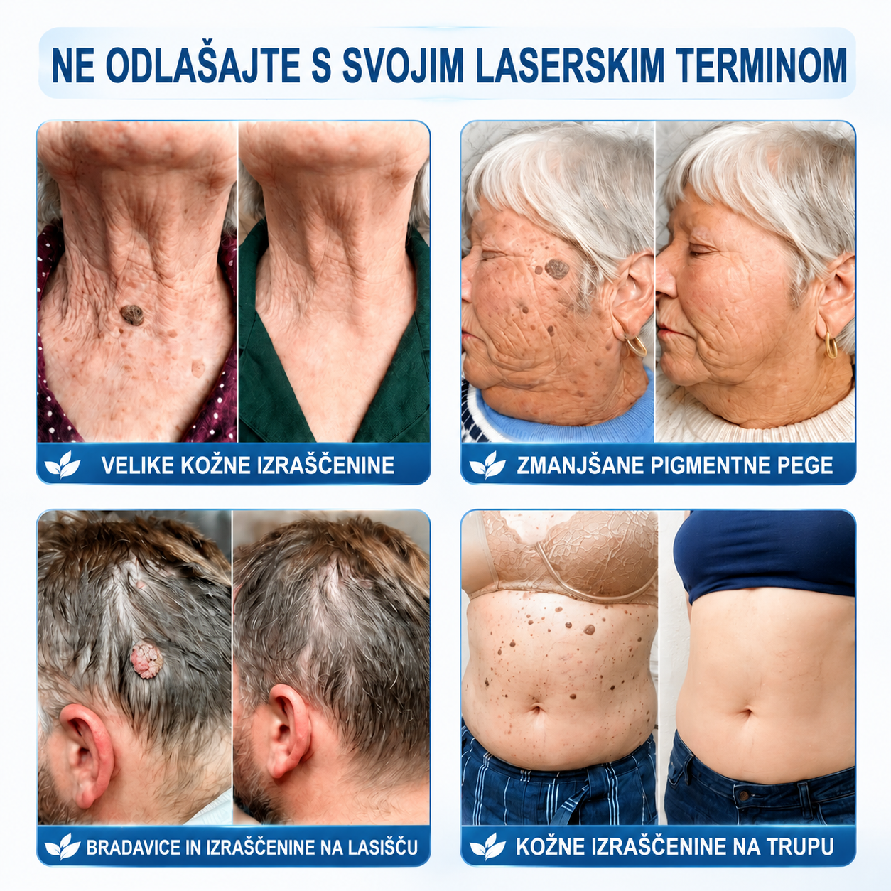 🎁 Posebna ponudba se kmalu izteče! Zdaj lahko prejmete dodatnih 30 % popusta, dokler so zaloge na voljo. Naročite še danes in izkoristite eno najboljših ponudb te sezone! 🔥
