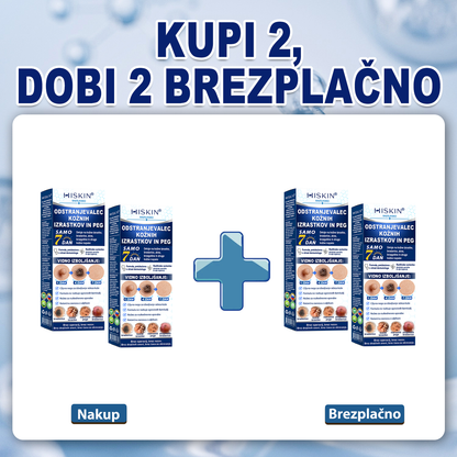 🎁 Posebna ponudba se kmalu izteče! Zdaj lahko prejmete dodatnih 30 % popusta, dokler so zaloge na voljo. Naročite še danes in izkoristite eno najboljših ponudb te sezone! 🔥