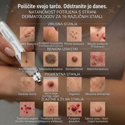 🎁 Posebna ponudba se kmalu izteče! Zdaj lahko prejmete dodatnih 30 % popusta, dokler so zaloge na voljo. Naročite še danes in izkoristite eno najboljših ponudb te sezone! 🔥